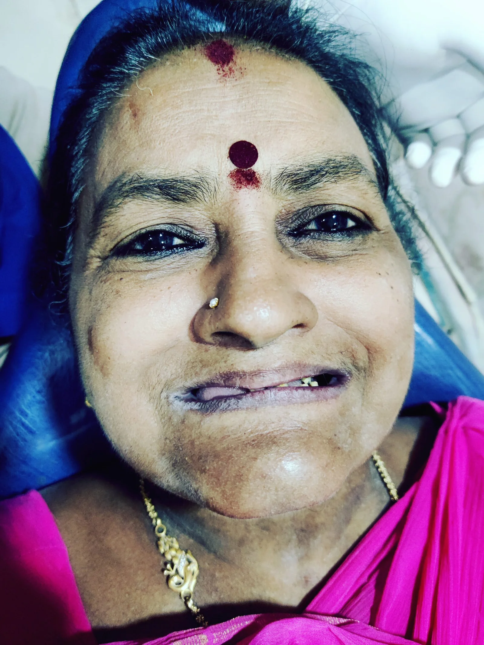 Before smile makeover