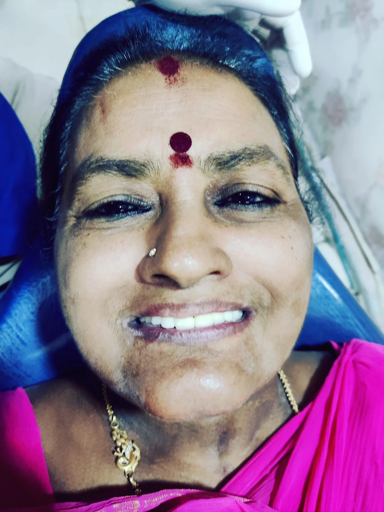 After smile makeover